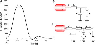 A Hemodynamic Analysis of the Thrombosis Within Occluded Coronary Arterial Fistulas With Terminal Aneurysms Using a Blood Stasis Model